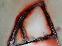 Repair patch during dye penetrant testing